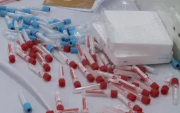 Vẫn quá tải xét nghiệm sán lợn tại Hà Nội