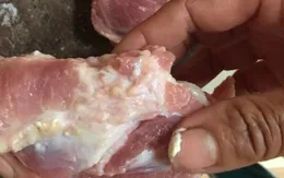 Cảnh báo nhiễm ấu trùng sán lợn