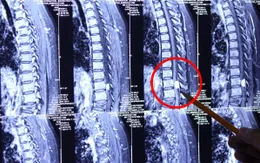 Không thể di chuyển do căn bệnh khó phát hiện trong ống sống