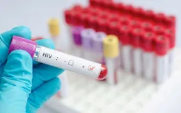 Gần 40% số ca nhiễm HIV mới tại Mỹ không biết mình bị nhiễm