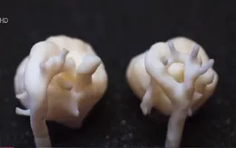 Anh tạo thành công hình ảnh 3D tim thai nhi