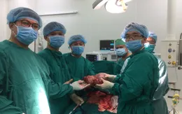Thường xuyên đau bụng, hóa ra có khối u lách nặng gần 3kg