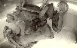 Ngỡ ngàng: Người đàn ông tắc ruột vì... ăn măng khô?