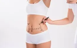 Cô gái trẻ tử vong do hút mỡ bụng