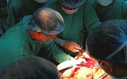Kỹ thuật mới trong phẫu thuật cắt gan