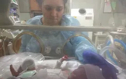 Em bé Mỹ sinh ra hoàn toàn không có da