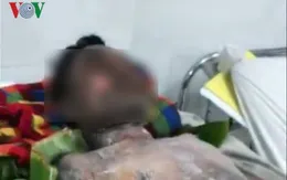 Bình gas mini phát nổ, nam thanh niên bị bỏng nặng