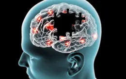 Điều trị Alzheimer bằng âm thanh và ánh sáng