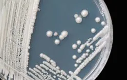 Hàng trăm người Mỹ nhiễm chủng nấm kháng thuốc Candida auris