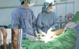 Suy giãn tĩnh mạch chi dưới không còn là mối lo