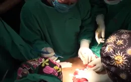 Người phụ nữ dân tộc Mường 15 năm mang trên mình khối u xơ thần kinh nặng 12kg