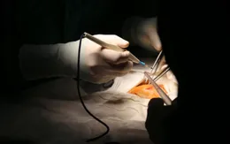 20 y, bác sĩ Sản - Nhi nỗ lực cứu sống bé song thai bị bệnh lý tim ngay khi vừa chào đời