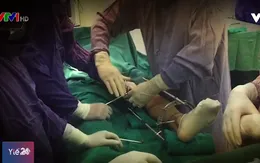 Kéo dài chân có suy giảm tuổi thọ?