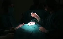 Tai nạn gãy dương vật và những khuyến cáo từ bác sĩ