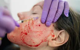 Mỹ điều tra cơ sở làm đẹp lây nhiễm HIV