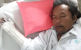 Người đàn ông tâm thần bị chấn thương sọ não cần giúp đỡ