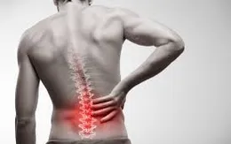 Nguyên nhân đau dọc sống lưng
