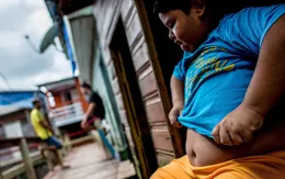 Báo động tình trạng thừa cân, béo phì gia tăng ở các vùng nông thôn