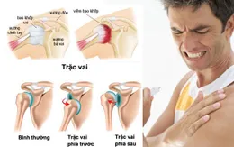 Khám, tư vấn miễn phí cho người bệnh có chỉ định phẫu thuật khớp vai, khớp khuỷu