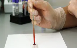 Phát minh thiết bị phát hiện vi khuẩn chỉ trong ít phút