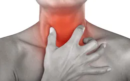 Nguyên nhân gây viêm họng, viêm thanh quản