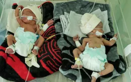 UNICEF cảnh báo về thực trạng chăm sóc sức khỏe bà mẹ và trẻ sơ sinh tại Yemen
