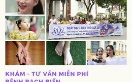 Khám, tư vấn miễn phí bệnh bạch biến tại Hà Nội