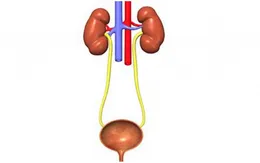 Cảnh báo bệnh nhiễm trùng đường tiết niệu ở trẻ