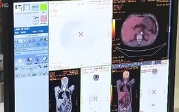 Sớm chuyển giao công nghệ điều trị ung thư mới tại Việt Nam