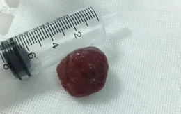 Trẻ đi ngoài ra máu, cha mẹ tuyệt đối không nên chủ quan vì nguyên nhân này