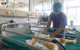 (Cập nhật) Tình hình cấp cứu 3 trẻ bị bỏng cồn trong giờ học ở Hà Nam