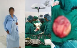 Người phụ nữ 14 năm sống chung với khối u buồng trứng nặng 25kg