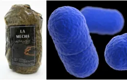 Tây Ban Nha "kích hoạt" cảnh báo y tế quốc gia về bệnh nhiễm khuẩn listeria