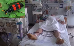 Cảnh báo nguy cơ ngộ độc từ sâu ban miêu