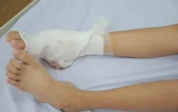 Cứu bé gái 14 tuổi mang căn bệnh hiếm gặp ở bàn chân