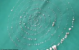 Phẫu thuật gỡ bỏ... 526 chiếc răng trong miệng cậu bé 7 tuổi