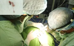 Ngòi bút chì bị gãy "ngủ quên" suốt 5 năm trong... mắt bé trai 13 tuổi