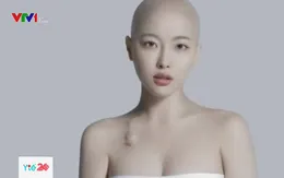 Nhật ký chiến đấu với ung thư của cô gái trẻ lay động triệu trái tim