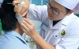 Cai nghiện thuốc lá bằng phương pháp y học cổ truyền