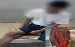 Nhiều ca mắc bệnh Whitmore được phát hiện, Bộ Y tế khuyến cáo phòng bệnh