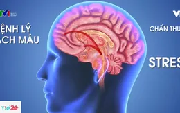 Căng thẳng có thể dẫn đến Alzheimer