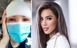 Siêu mẫu Khả Trang bị tai nạn hy hữu phải khâu 10 mũi