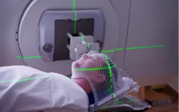 Điều trị toàn bộ đợt xạ trị ung thư chỉ chưa đầy 1 giây