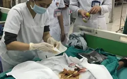Sốc nhiễm khuẩn, viêm tụy cấp nặng, xơ gan do nghiện rượu