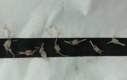 Bé 1 tuổi nhập viện vì hóc... 7 chiếc xương cá
