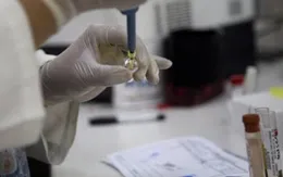 Vaccine ngừa virus corona có thể được thử nghiệm trong 3 tháng tới