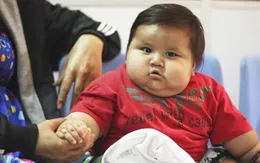 Béo phì có liên quan đến tổn thương não ở trẻ em và thanh thiếu niên