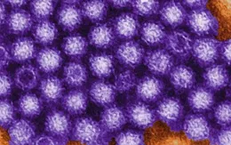 Hàng loạt sinh viên Trung Quốc nghi nhiễm norovirus
