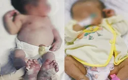 Ngỡ ngàng: Bé vừa chào đời đã mắc giang mai bẩm sinh