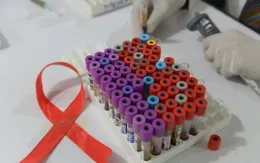 Thế giới có bệnh nhân thứ hai tự khỏi HIV